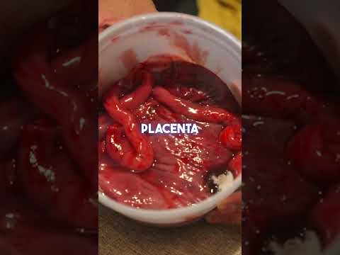 Observing a 4 month old Placenta #shorts