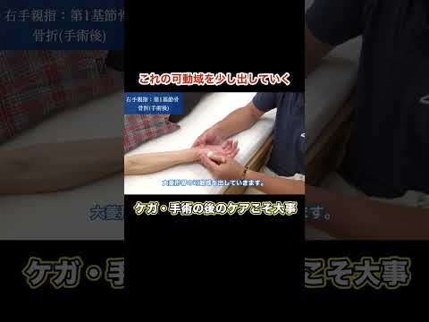 【施術公開】ケガや手術後のケアが肝心！＃骨折＃手指骨折＃整体 ＃健美サロン渡部 #shorts