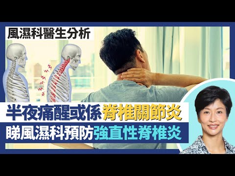 脊椎關節炎／強直性脊椎炎｜風濕科及早治療炎症預防僵硬併發症！半夜腰背痛醒可能係脊椎關節炎？脊骨發炎後生新骨致無法彎曲！｜王建芳醫生 風濕科醫生陳昭慧醫生 鍾浩然醫生｜人類健康研究所