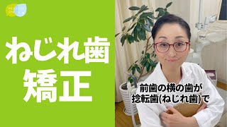 【捻転歯】矯正や抜歯をすると輪郭に影響が出ると見て怖いです #shorts