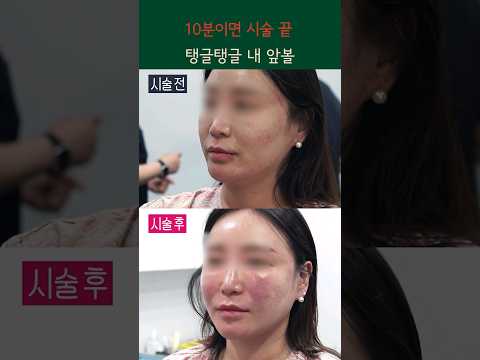 10분컷 앞볼이 탱글탱글 해져요