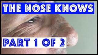 The Nose Knows: Part I "Mr. Wilson's" Blackhead Extractions