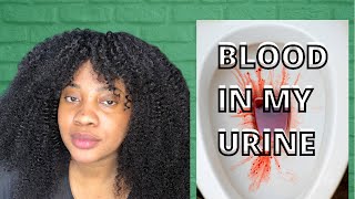 This is Why You See Blood in Your Urine / Know These 3 Things!!!