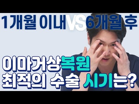 이마거상복원 언제해야 가장 좋지? 최적의 이마거상 복원 시기! 테일러성형외과