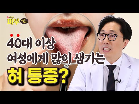 혀가 뜨겁고 따가운 ‘구강 작열감 증후군’ 참을만하다고 방치하면 몸 전체가 무너집니다 - 박치영의 피부 톡톡 #154