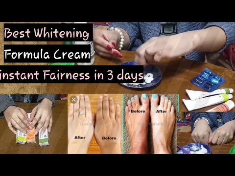 Fairness In 3 day's| Best Whitening formula Cream|No Side effects|100% grantee|Get Soft| Fairer skin