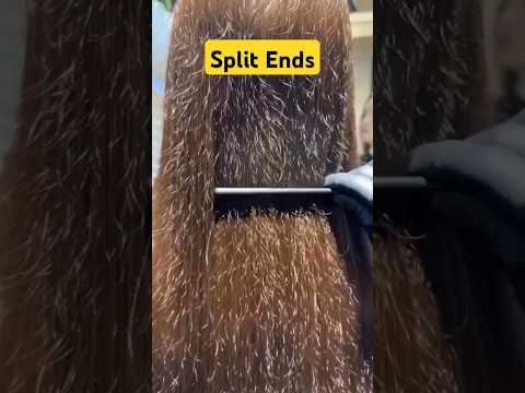 How to get rid of Split Ends? #splitends #frizzyhair #haircare #shorts #dadumedicalcentre