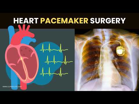 Heart Pacemaker Surgery: Everything You Need to Know