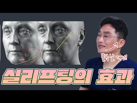 더 젊어보이는 비결! 불독살을 끌어~~올려! 실리프팅의 효과