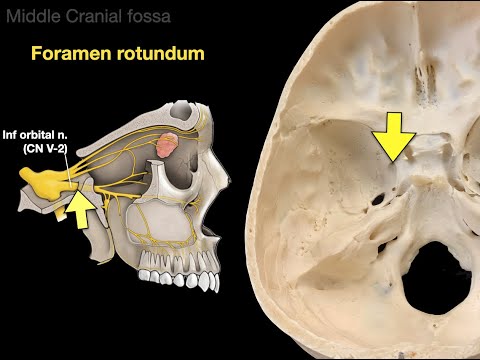 The Skull