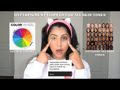 GRWM: HOW TO COVER & REDUCE HYPERPIGMENTATION/DARK CIRCLES