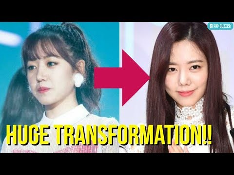 Apink Namjoo Plastic Surgery Becomes Viral News, Plan A Refused To Comment