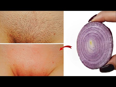 Stop shaving! Here's how to get rid permanently facial, body and pubic hair