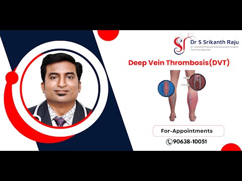 DVT- Deep Vein Thrombosis | Causes | Symptoms | Treatment | Dr.Srikanth Raju | Vascular Surgeon