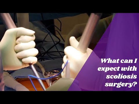 What can I expect with scoliosis surgery?