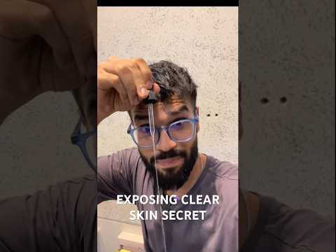 EXPOSING Glowing Skin Secret To Get Acne Free Skin | Clear Skin | BeYourBest Skincare by San Kalra