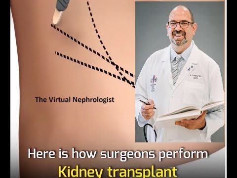 Kidney Transplant Surgery | The Virtual Nephrologist | Dr. Rifai