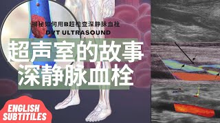 下肢深静脉血栓：深静脉血栓是什么/血栓是如何形成的/ 常见症状/肺栓塞/B超如何检查/治疗方法/ 如何预防深静脉血栓【Ultrasound Room】Deep Vein Thrombosis