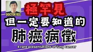 罕見肺癌病徵 rare signs of lung cancer