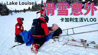 [加拿大生活玩樂VLOG] [CALGARY] Lake Louise 滑雪意外🥶Urgent Care照 X-ray等咗X個鐘?