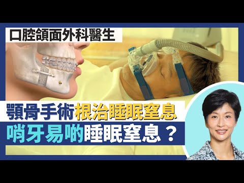 根治睡眠窒息症｜哨牙較易患睡眠窒息？牙科MMA手術移前顎骨治療睡眠窒息！不做手術或戴呼吸機可用牙膠改善睡眠質素｜王建芳醫生 口腔頜面外科醫生徐偉堅醫生｜人類健康研究所