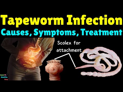 Tapeworm Infection: Symptoms, Causes, Life Cycle, Diagnosis, Treatments, Complications & Prevention