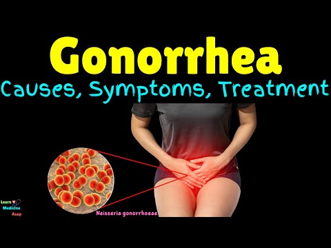 Gonorrhea: Causes, Symptoms, Diagnosis, Treatment, Complications & Prevention