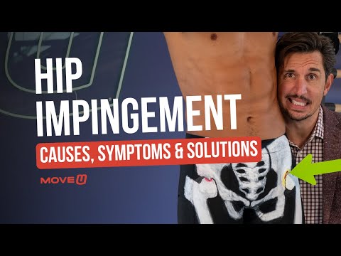 Hip Impingement: Causes, Symptoms, Best Treatment Options