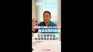 無法忽視的疼痛：49歲腹中竟藏18公分巨瘤 仍在繼續增長 決定不再忍受這些痛苦 她選擇海扶刀免開刀治療！#無法忽視的疼痛 #巨大肌瘤 #海扶刀 #無創治療 #免開刀  #肌瘤治療 #壓迫症狀