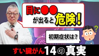 すい臓がんの質問にすべて答えます【特徴/初期症状/ステージ4/早期発見/費用/末期/検診/遺伝/治療/余命/完治/予防】