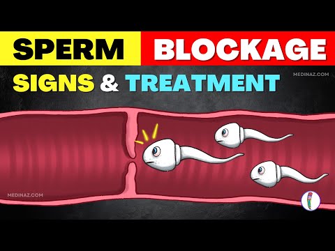 Sperm Blockage - Causes, Symptoms, and Effective Treatments | Male Infertility Treatment | Low Sperm