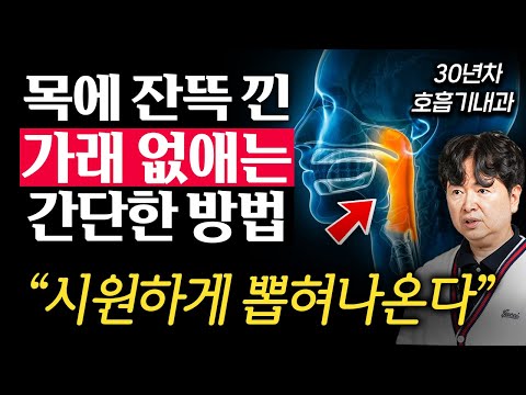 "절대 삼키지 마세요." 묵은 가래 싹 없애는 '3가지' 호흡법 (진성림 원장 1부)