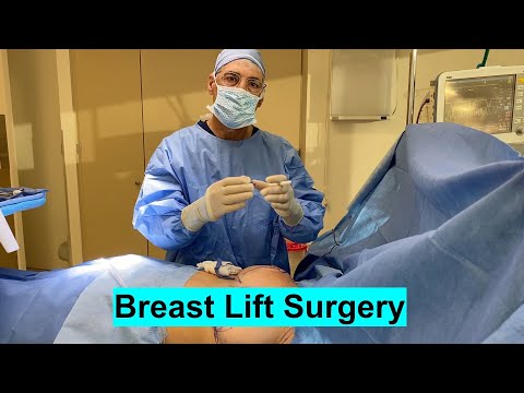 Full Mastopexy aka BREAST LIFT Surgery in the Operating Room