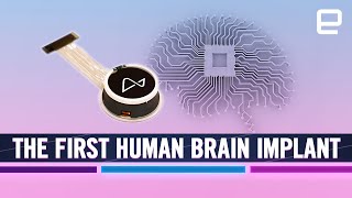 Elon Musk’s Neuralink brain implant: New era of "Brain-Computer Interface" (BCI) technology