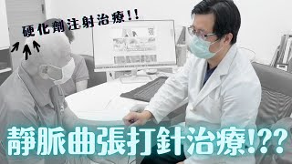 靜脈曲張硬化劑治療、治療一週後成效現身說法-極緻美型·文心極緻皮膚科診所整形手術-林子鈞醫師：靜脈曲張_台中靜脈曲張_硬化劑_雷射治療_注射治療