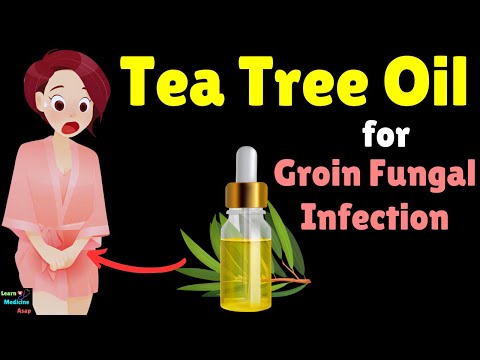 How to Use Tea Tree Oil for Jock Itch (Groin Fungal Infection)