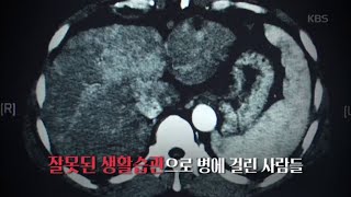 잘못된 생활습관으로 병에 걸린 사람들 [생로병사의 비밀] 20200429