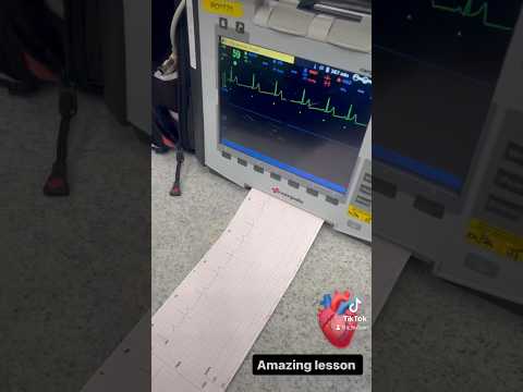 🫀#ALevel Biology lesson on ECG’s #ecg #cardiology #classroom #school #biology #science #teacher