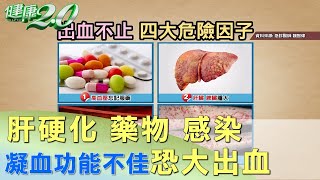 肝硬化 藥物 感染 凝血功能不佳恐大出血 健康2.0