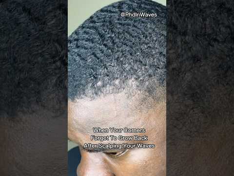 Hairline Receding 360 Waves