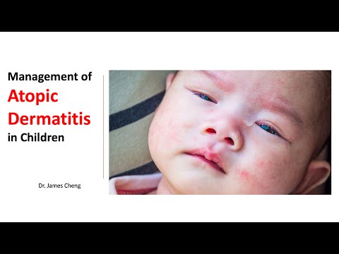 Management of Atopic Dermatitis in Children by Dr James Cheng (28 Jan 2022)