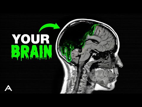 Brain Rot is Far Worse Than You Think