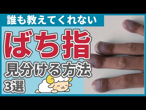 【悩む人多数】ばち指の見分け方3選【原因疾患も解説】