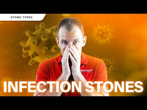 Do You Form "Infection" Stones?