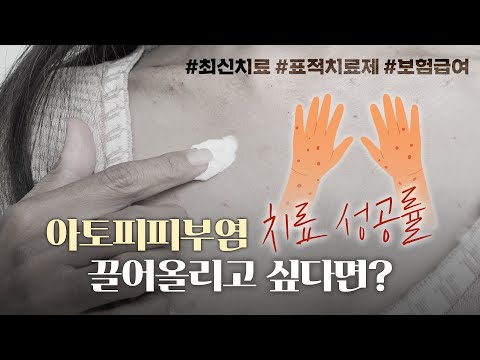 아토피피부염, 평생 질환에서 관리 가능한 삶으로!