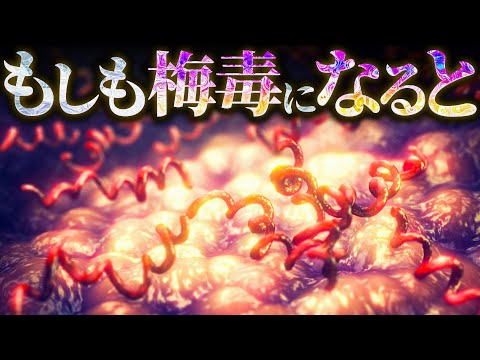 【鼻がもげる】梅毒になるとどうなるのか？