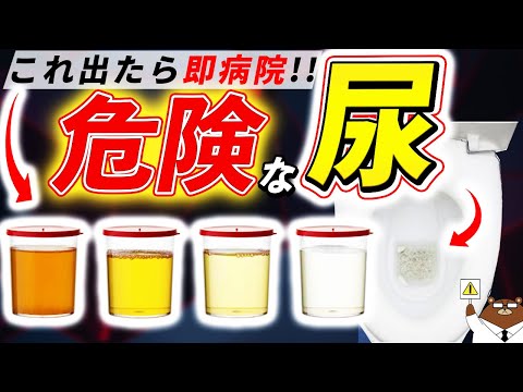 色・臭い・泡立ち・回数..絶対に見逃してはいけない「おしっこ」からのSOS。知らないと後悔する超意外なサインとは？医師が徹底解説！