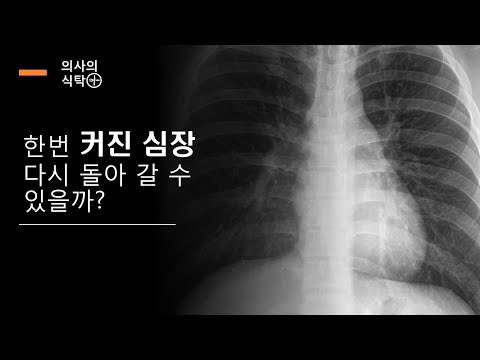 심비대 (2) : 한번 커진 심장 다시 돌아갈 수 있을까?