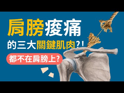 肩膀痛舉不高？放鬆這三條肌肉超有效！| 肩膀酸痛的三條關鍵肌肉 | 阿舟物理治療師