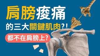 肩膀痛舉不高？放鬆這三條肌肉超有效！| 肩膀酸痛的三條關鍵肌肉 | 阿舟物理治療師